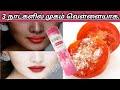 3 நாட்களில் முகம் வெள்ளையாக... |Skin Whitening | Taj