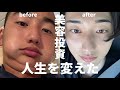 ガチで人生が変わった美容投資4選