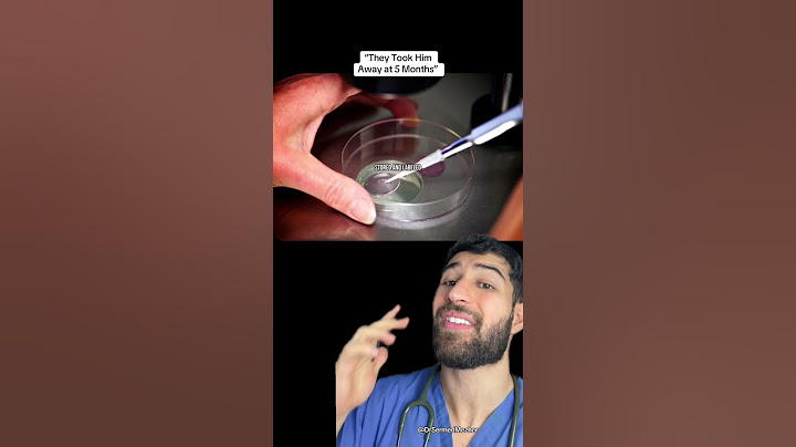 “They Took Him Away at 5 Months” #IVF