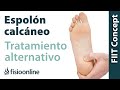 Espolón calcáneo - Visión desde la medicina natural