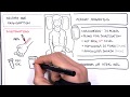 Diabetic Ketoacidosis (Diabetes Type I) Management Summary