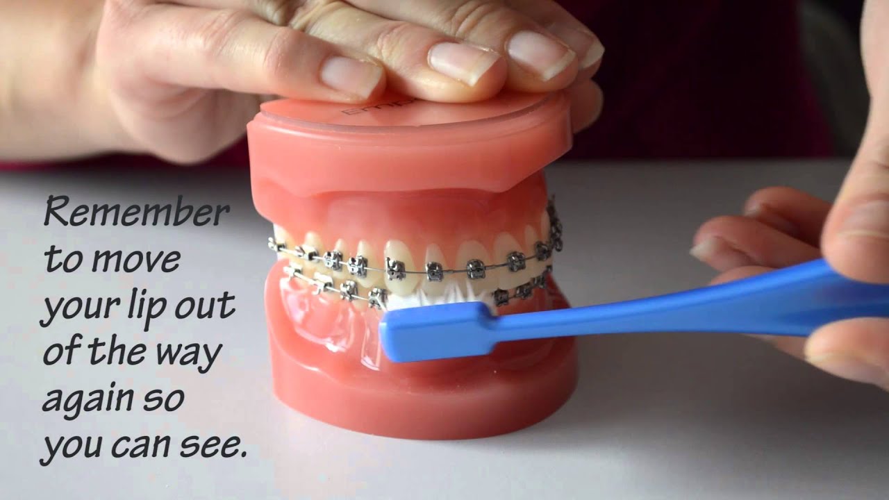 How do I brush with braces? YouTube