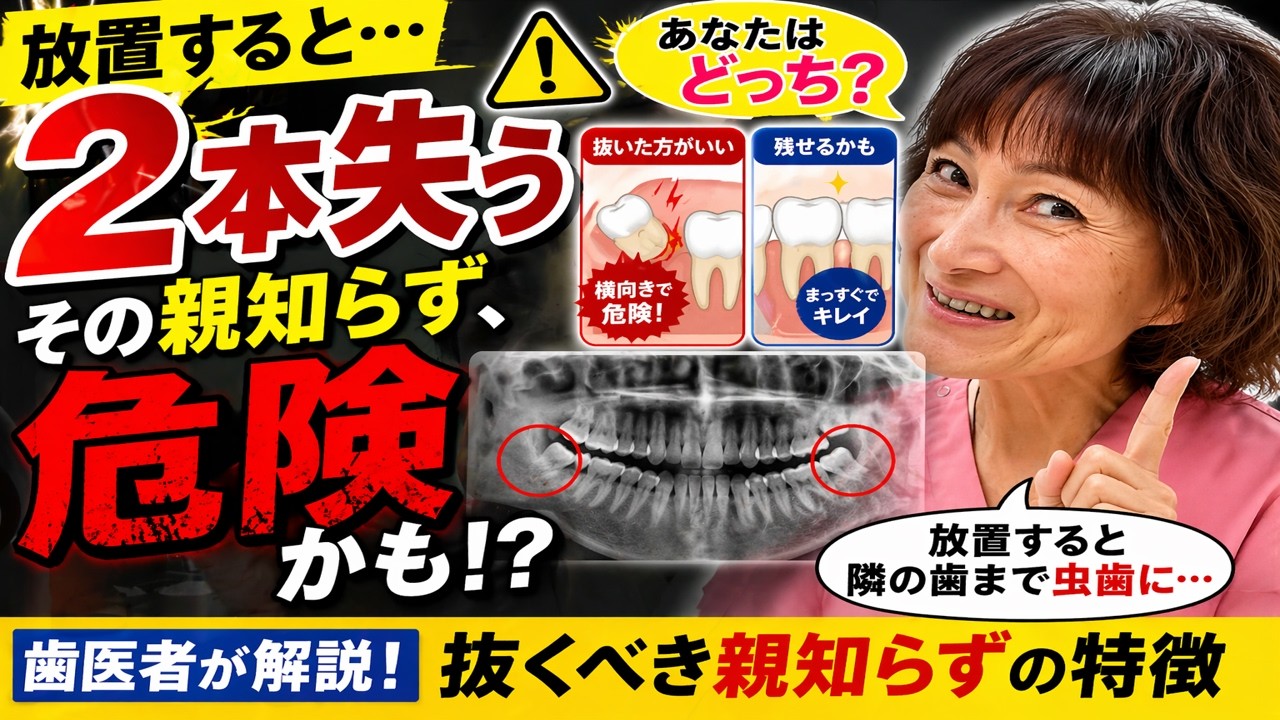 親知らず、放置すると“隣の歯も死にます”【歯医者解説】