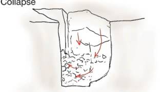 Types of Trench Collapse