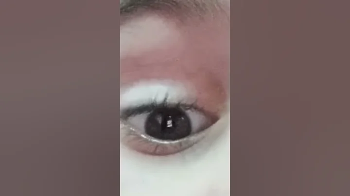 The Eye
