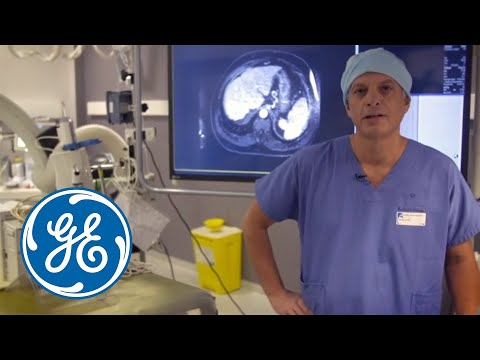 Complex radiofrequency ablation with GE’s Innova IGS 540 and LOGIQ E9 XDclear 2.0 | GE Healthcare