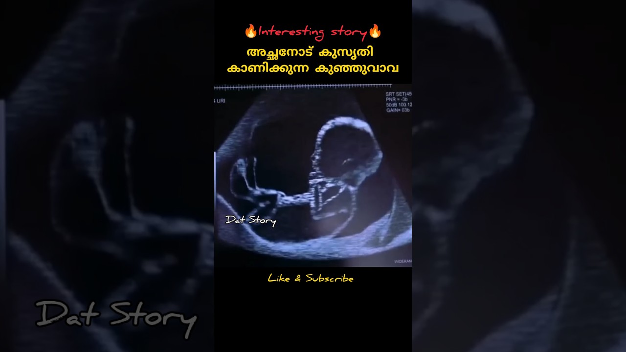 അച്ഛനോട് കുസൃതി കാണിക്കുന്ന കുഞ്ഞുവാവ l Malayalam voiceover l 