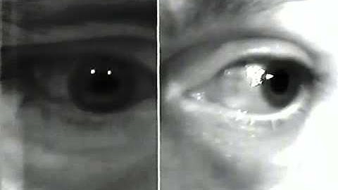 Aberrant Regeneration of the Third