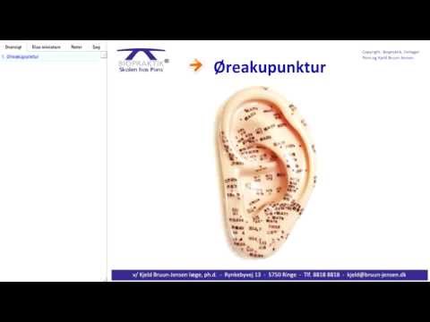 Video: Akupunktur - Anmeldelser, Typer, Anvendelse