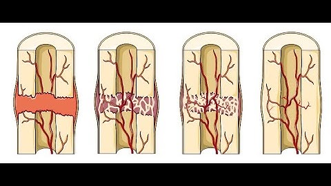 PLGA from PolySciTech used in research on bone-scaffold for tissue repair.