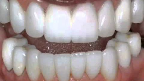 Dental Care at Home