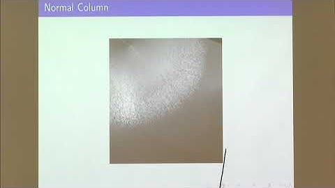 Multiple Speakers | Segregation effects in granular collapses