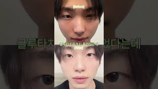 흙톤이던 아이돌 연습생이 데뷔전에받는 미백관리 #후기 #kbeauty #미백