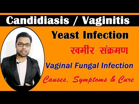 यीस्ट-इन्फेक्शन--जलन-खुजली-और-संक्रमण-का-इलाज-|-candida-yeast-infection-|-candidiasis-|-vaginitis