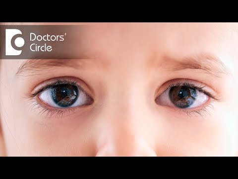 ვიდეო: ყველას აქვს სხვადასხვა ზომის თვალები?