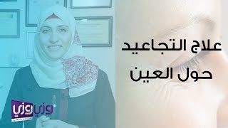 علاج التجاعيد حول العين