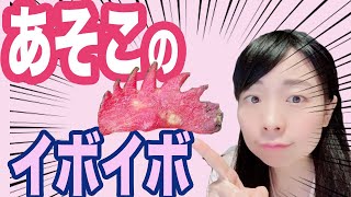 【女医が解説】あそこにできるイボイボ、他の人にもうつるかも？【産婦人科】