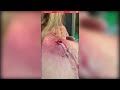 Popping huge blackheads and giant pimples  best pimple poppings 129