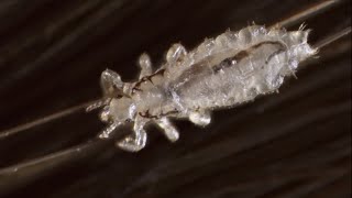 Qué Pasa Con Los Piojos