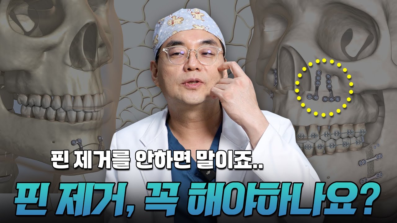 양윤돌 수술 후 핀 제거 꼭 해야 하나요?