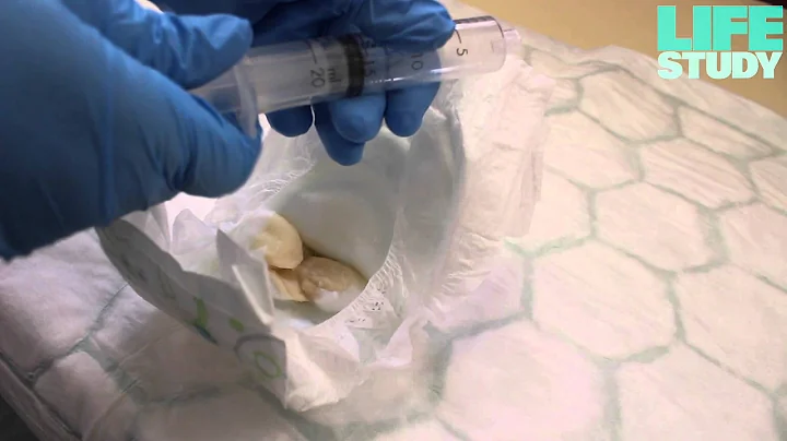 How to collect baby urine