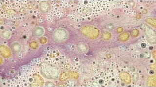 Surfactants In Milk Foam