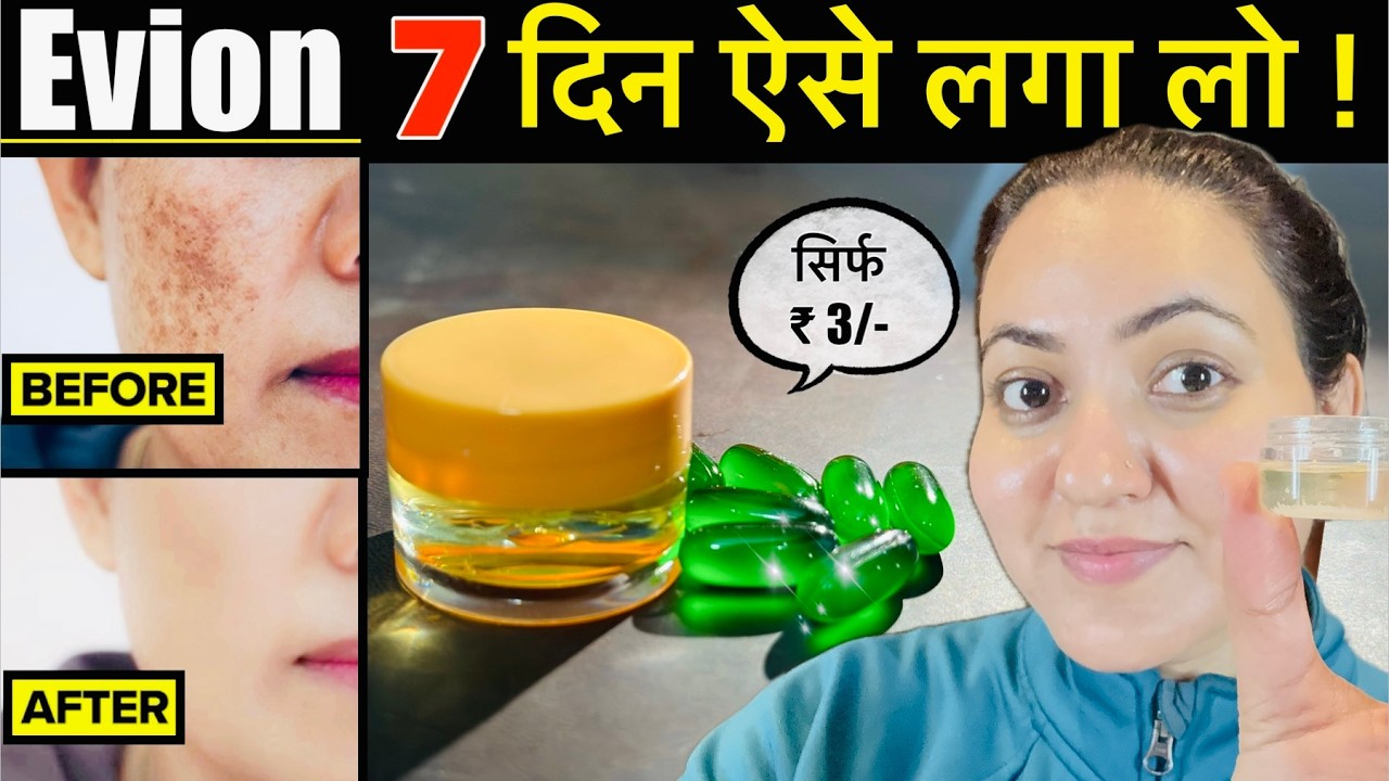 3 रूपए की चीज़ से पाए गोरी निखरी Skin हमेशा के लिए -Vitamin E se झाइयाँ Open Pores Pigmentation गायब💕