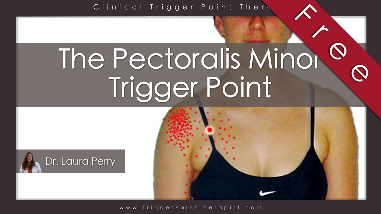 The Pectoralis Minor Trigger Point (Free Full Video) - YouTube