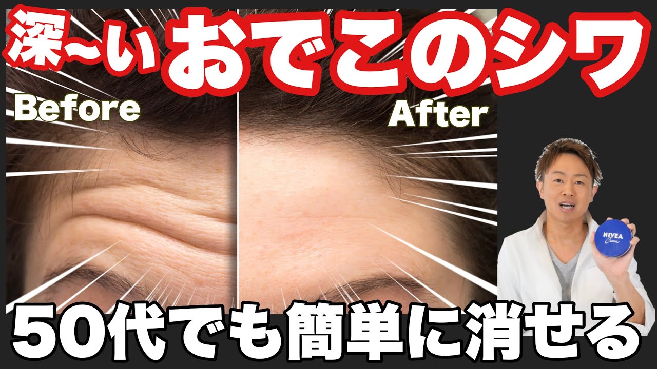 眉間のシワを消す簡単な方法