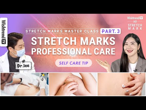 All About <strong>Stretch</strong> Marks: Asked a Dermatologist and Self Care Tips | <strong>Stretch</strong> <strong>Mark</strong> Master Class PART.3