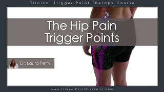 The Hip Pain Trigger Points