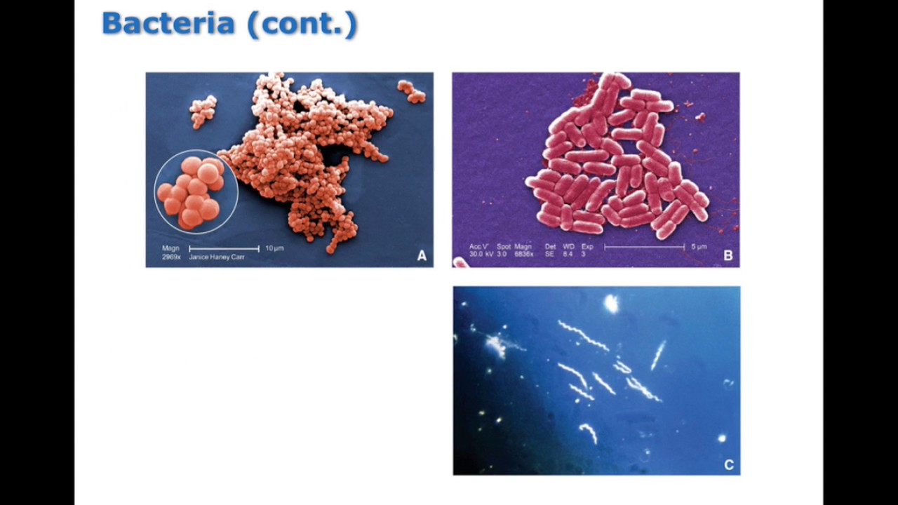 Biological Infectious Chapter 14 Mechanisms of Infectious Disease BIO216 - YouTube