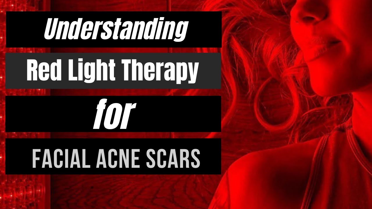 Understanding Red Light Therapy for Facial Acne Scars YouTube