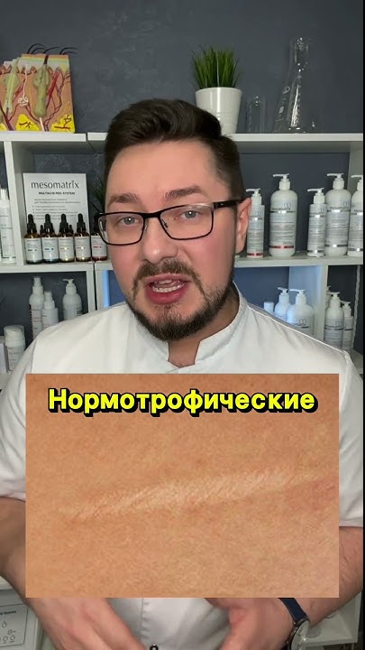 Виды рубцов (шрамов) Продолжаем тему? Ставьте - YouTube