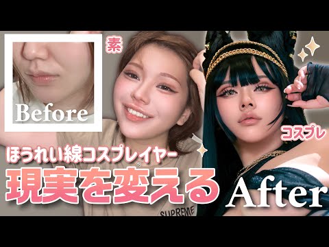 【整形】ほうれい線ぶっ濃いコスプレイヤーの現実を変える✨
