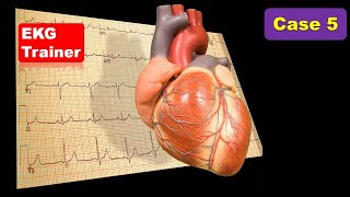 EKG Trainer Case 5 رسم قلب محاضرات باطنة CME Internal Medicine USMLE Cardiology Medical Quizzes screenshot 5