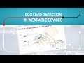 Electrocardiogram (ECG) lead detection in wearable devices
