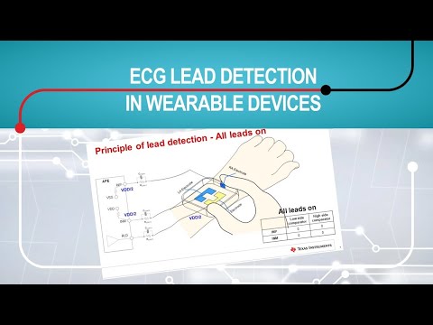 Electrocardiogram (ECG) lead detection in wearable devices