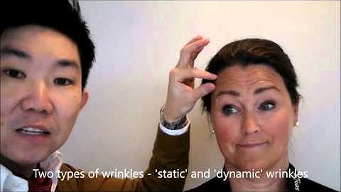 Dr Kieren Bong - Botox for Static/Dynamic Wrinkles Explanation