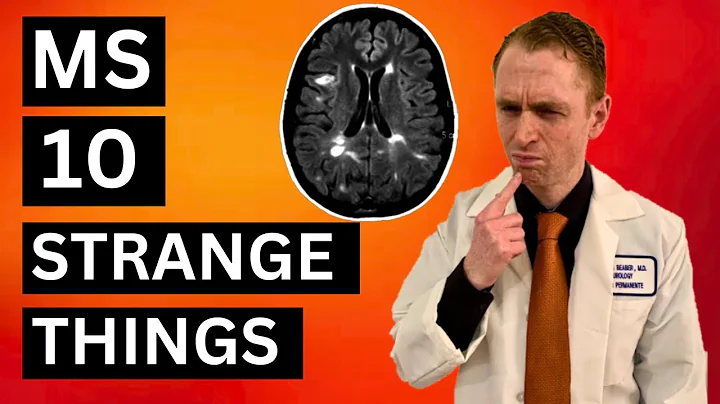 10 Strange Things About Multiple Sclerosis
