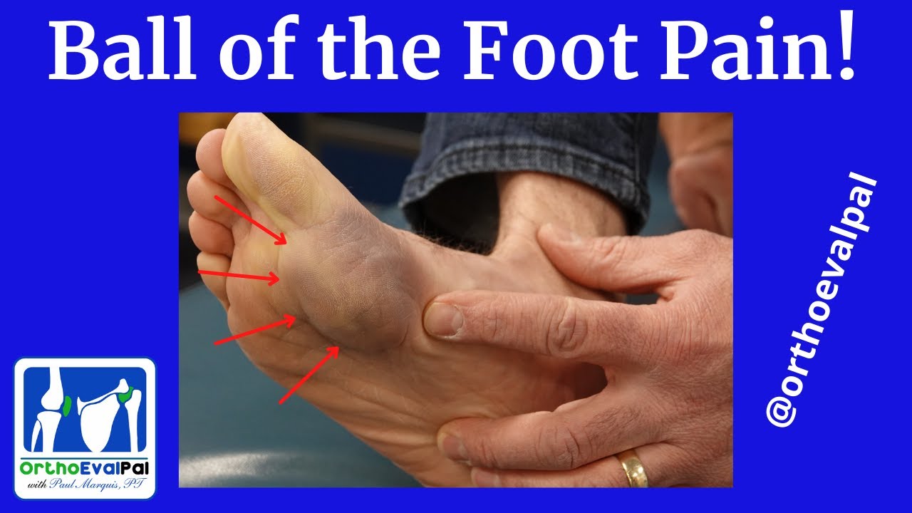 Definition, Bones, and Structure of the Forefoot