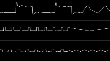 Tero Hilpinen - "Sphere Brain (C64) - BGM 2 (At Last)" (Real SID) [Oscilloscope View] (acrouzet)