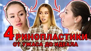 Доктор изуродовал мой НОС! 4 РИНОПЛАСТИКИ! Моя история! Про докторов и цены!#ринопластика #пластика