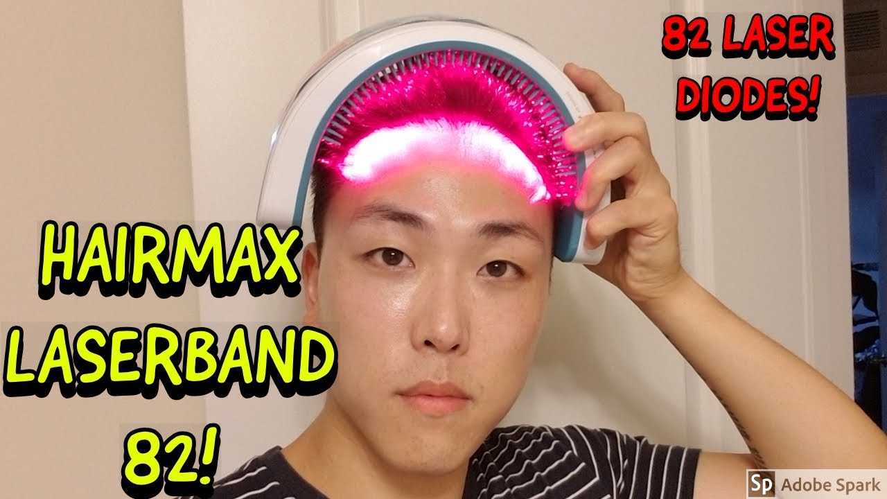 HAIRMAX LASERBAND 82 REVIEW FOR HAIR LOSS TREATMENT! - YouTube