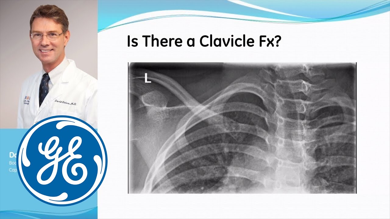 mrid дикий яд ремикс Orthopedic Applications of VolumeRAD* Digital Tomosynthesis: with Dr. David Quinn