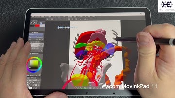 XR Operative Report by Holoeyes & Wacom