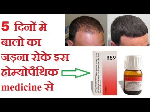 Hair Fall and Homeopathic Cure with 20 Real Time Cases  YouTube
