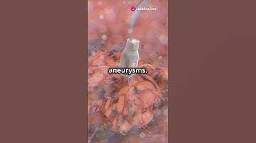 Scientists Test Nanorobots to Treat Brain Aneurysms#sciencefather #brain