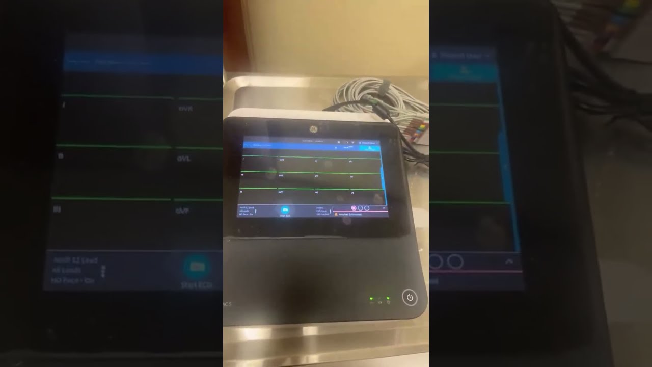 GE MAC 5 ECG Machine