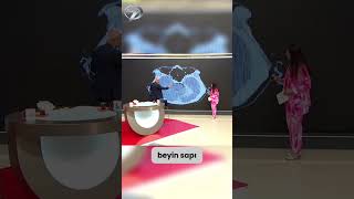 Beyin Kanaması nasıl oluşur En çok nelere Dikkat etmemiz gerekiyor? #shorts #haber #gündem